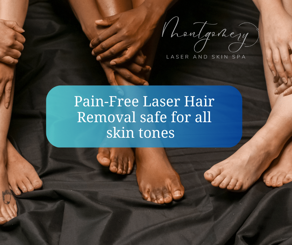 Pain-Free laser hair removal with Motus AZ +