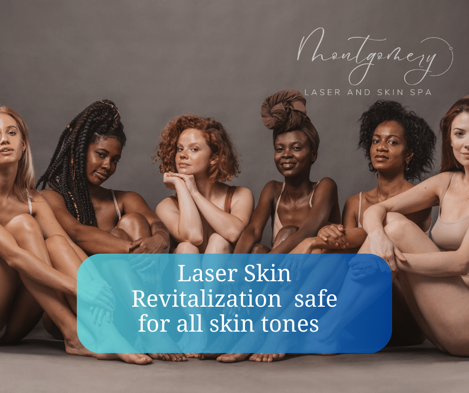 Laser skin revitalization safe for all skin tones