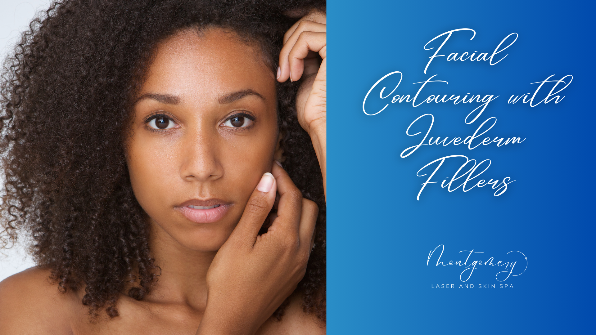 Facial Contouring with Juvederm Fillers at Montgomery Laser and Skin Spa